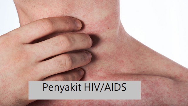 Bahaya Penyakit Hiv/AIDS