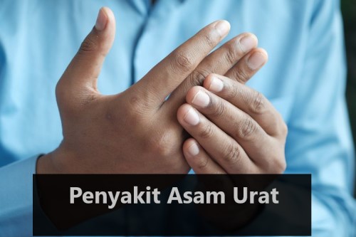 Penyakit Asam Urat